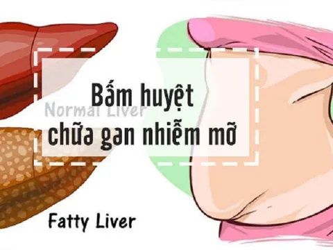 Bấm huyệt điều trị gan nhiễm mỡ - liệu pháp đơn giản mà hiệu quả vô cùng