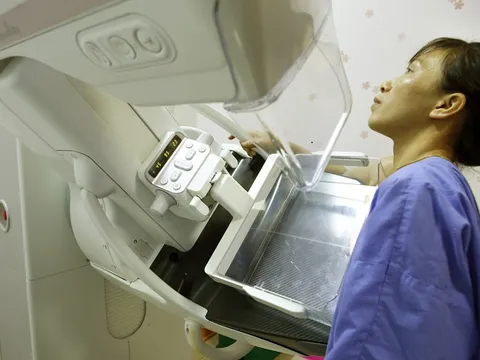 Bệnh viện Bạch Mai ứng dụng kỹ thuật mới phát hiện ung thư vú sớm và loại bỏ hoàn toàn tổn thương vú