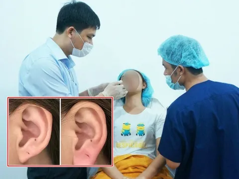 Chuyên gia thẩm mỹ nói về trào lưu 'tiêm tai tài lộc' đang khiến chị em phát sốt