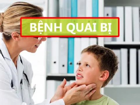 Bài thuốc dân gian chữa chứng quai bị từ nguyên liệu quanh nhà