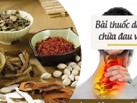 Những bài thuốc chữa đau vai gáy 'nức tiếng' trong dân gian