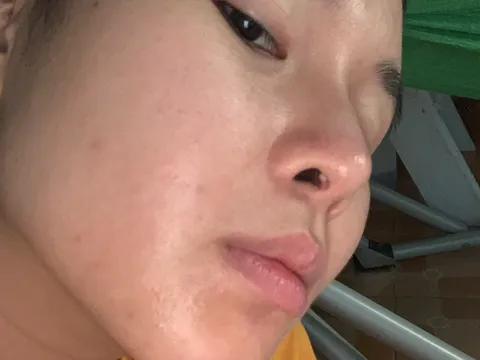 BV Bảo Sơn 2 lập Hội đồng chuyên môn về vụ BS Trần Ngọc Phương bị tố làm hỏng mũi