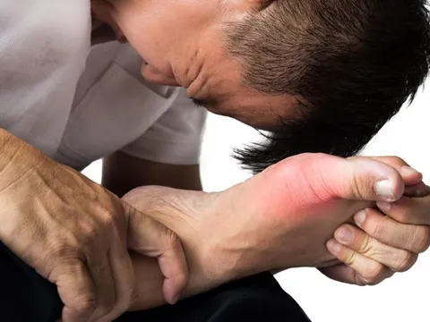 Sốc: 'Cậu nhỏ' bị gút vì chủ nhân hơn 10 năm không làm 'chuyện ấy'