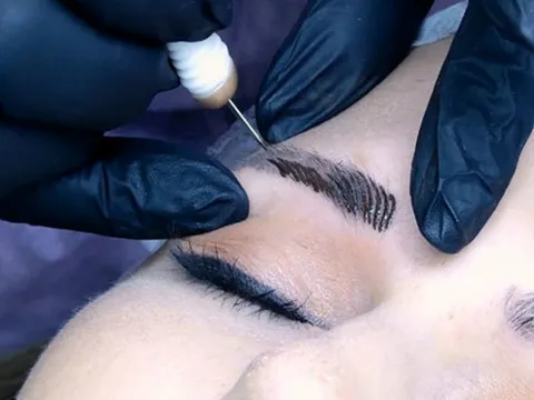 Người phụ nữ hôn mê, xuất huyết não sau khi xăm chân mày tại spa 