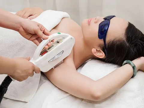 So sánh ưu nhược điểm của các phương pháp triệt lông hiệu quả nhất hiện nay