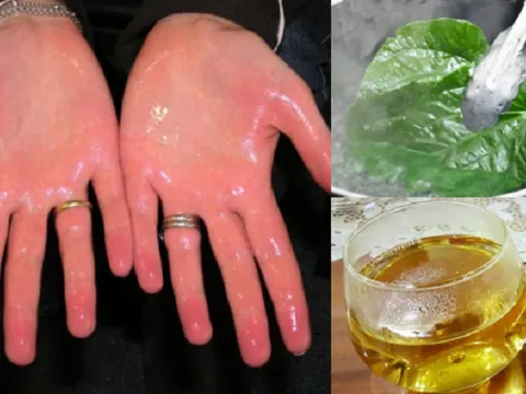 Mẹo 'khử' mồ hôi chân tay đơn giản từ nguyên liệu tự nhiên