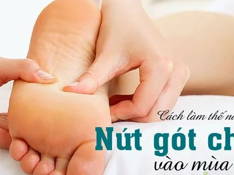 Mẹo chữa nứt gót chân bằng nguyên liệu tự nhiên