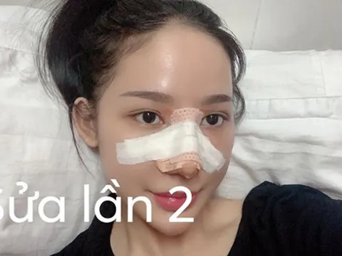 4 lần nâng mũi đến hết sạch sụn tai, cô gái 23 tuổi từng nhiều lần nghĩ quẩn vì phẫu thuật hỏng