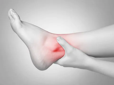 Bệnh viêm khớp cổ chân và 2 bài thuốc dân gian điều trị đơn giản mà hiệu quả