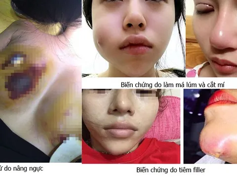 Vinh-Nghệ An: Thẩm mỹ viện tràn lan nhưng mới chỉ 4 cơ sở được cấp phép