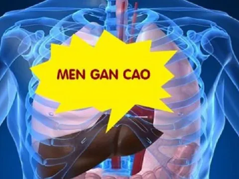 Lương y tư vấn cách điều trị tận gốc men gan cao