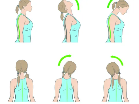 Loại bỏ ngay cảm giác đau cổ khó chịu bằng những biện pháp đơn giản tại nhà