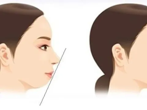 Có 5 đặc điểm này trên mặt thì dù cố đến mấy vẫn nghèo kiết xác, cả đời lận đận long đong