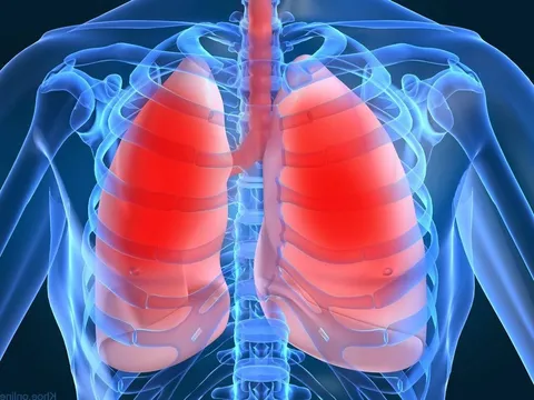 Kháng sinh tự nhiên tăng cường sức khỏe cho 2 lá phổi giúp phòng ngừa bệnh trong mùa dịch
