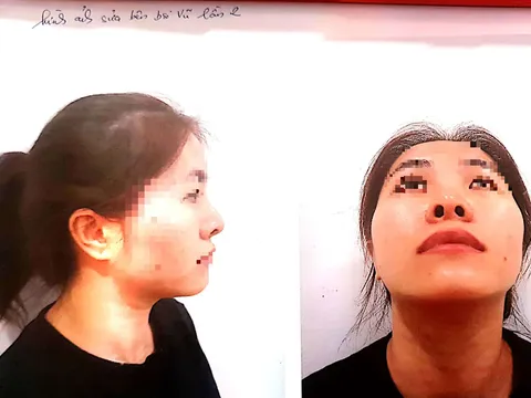 Cô gái tố cáo hoạt động thẩm mỹ của ông Võ Ngọc Vũ và Tô Khả Đạt