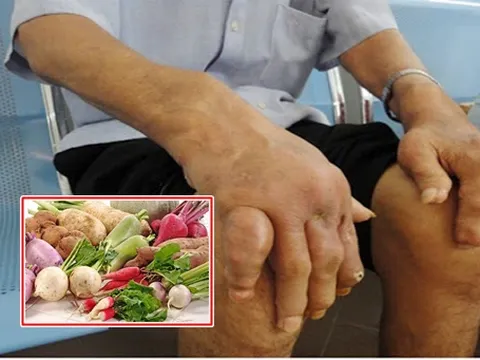 Chế độ ăn cho người bệnh gout: Những điều nhất định phải nhớ