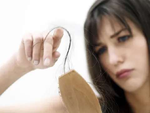 Mẹo hay cải thiện tình trạng rụng tóc sau sinh tại nhà