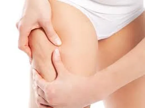 Bạn đang đau khổ vì mỡ đùi, dùng ngay bí quyết dưới đây chẳng mấy chốc chân thon như ý
