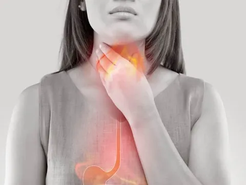 4 mẹo hay đẩy lùi chứng ợ nóng khi mang thai, bà bầu nào cũng áp dụng được