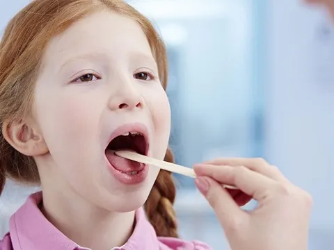Nhận diện triệu chứng viêm họng ở trẻ em, cha mẹ hết sức để ý trong mùa thời tiết ẩm ương này