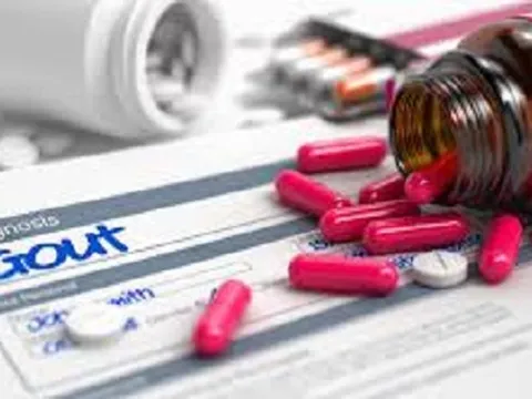 Allopurinol - “vũ khí” trong điều trị bệnh gout và những lưu ý nhất định người dùng cần nắm rõ
