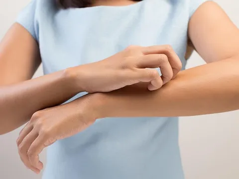 10 dấu hiệu này 'tố cáo' bạn đang mắc bệnh thận, đi khám ngay kẻo biến chứng nguy hiểm