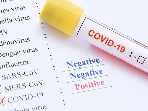 Tin tức xã hội mới nhất ngày 18/3/2020: Nhiều quốc gia đặt mua KIT thử COVID-19 của Việt Nam