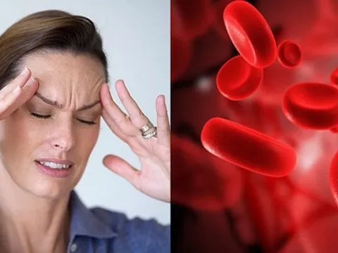 Dùng thuốc Vinpocetin trị thiểu năng tuần hoàn não, người bệnh nhớ lưu ý những điều này