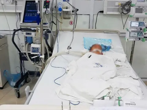 Cha mẹ mua cồn 90 độ về sát khuẩn tay phòng COVID-19, bé trai nghịch với lửa gây bỏng nặng