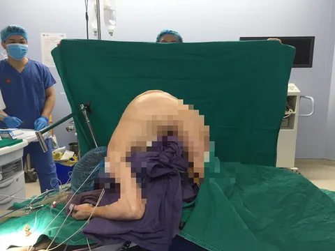 Giải cứu người đàn ông gù gập người như sâu đo, suốt 10 năm qua không thể nằm ngửa ngủ