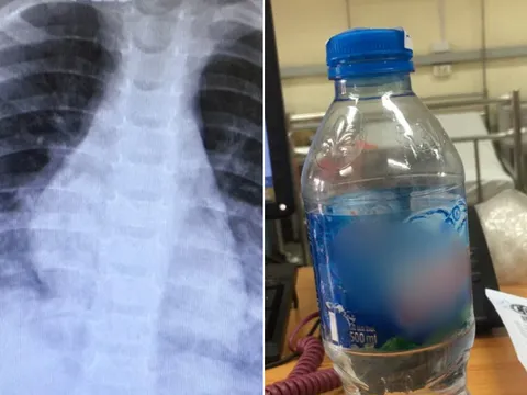 Bé 2 tuổi nôn ra máu vì uống nhầm thuốc tẩy trắng đựng trong chai nước khoáng