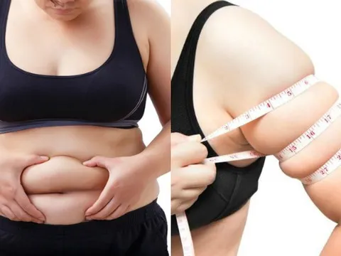 5 vị trí tích mỡ trên cơ thể tiết lộ tình trạng sức khỏe và biện pháp đánh bay mỡ thừa hiệu quả