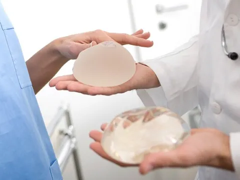 Ba người tử vong do ung thư hiếm gặp sau nâng ngực bằng túi nhám, buộc nhà sản xuất phải bồi thường