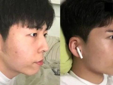 Fan cuồng quyết phẫu thuật thẩm mỹ thành bản sao Park Bo Gum, Jimin (BTS) và cái kết dở khóc dở cười