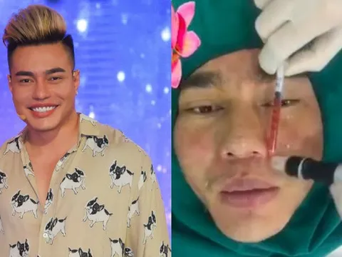 Lê Dương Bảo Lâm tiết lộ phẫu thuật thẩm mỹ toàn bộ gương mặt, nhờ biết cách nên không hề đơ cứng