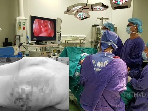 Ham tiêm mỡ nâng mông không cần phẫu thuật, cô gái trẻ hoại tử vòng 3, nhiễm khuẩn đa kháng thuốc