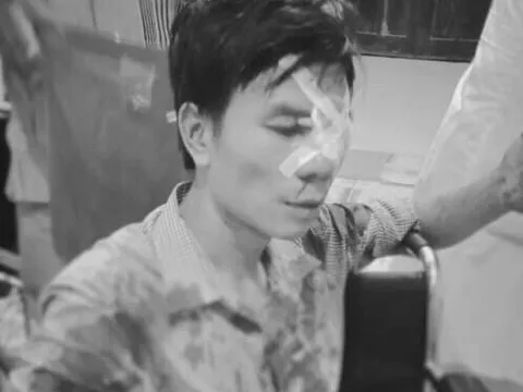 Danh tính cán bộ địa chính xã bị `tố` dùng xẻng đánh người trọng thương sau va chạm giao thông