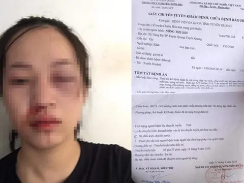 Công an Tuyên Quang nói gì về vụ CSGT bị 'tố' dùng gậy vụt mặt người phụ nữ đi xe máy?