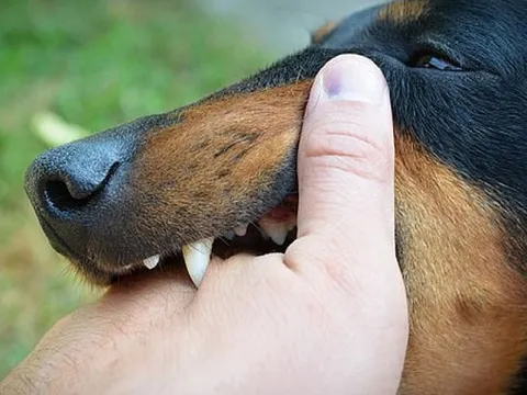 Sang nhà hàng xóm chơi đùa, bé gái 2 tuổi bị chó cắn rách vùng đầu mặt, lộ sọ