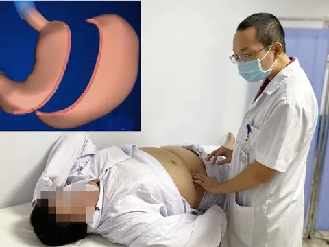 Cô nàng béo phì, mắc nhiều bệnh nền giảm 5kg/tuần nhờ phẫu thuật thu nhỏ bộ phận này