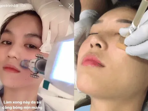 Bật mí phương pháp cấy tinh chất da cá hồi cho Ngọc Trinh làn da đẹp như baby, giá 8 triệu đồng/lượt