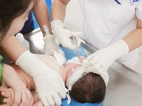 Bé trai bị bỏng nặng, tổn thương mắt do đùa nghịch bát mì tôm đổ vào mặt