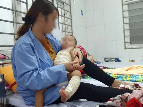 Xót xa bé trai 13 tháng tuổi bị nhiễm trùng, hoại tử nặng do cha mẹ đắp thuốc lá chữa bỏng 