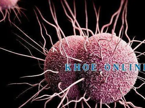 Bệnh lậu ở nữ giới và những giải pháp phòng tránh cần thiết