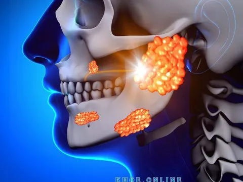 Tìm hiểu về bệnh quai bị ở nam giới
