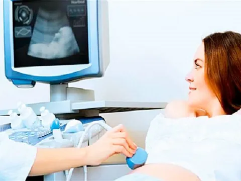 Xét nghiệm dị tật thai nhi những điều cần biết