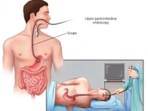 Ai có nguy cơ mắc ung thư dạ dày?