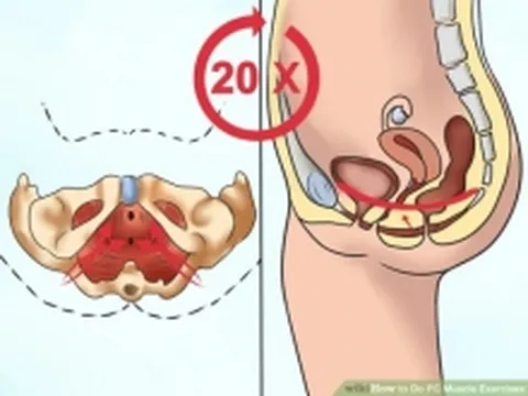 Bài tập Kegel giúp "một người khỏe, hai người vui"