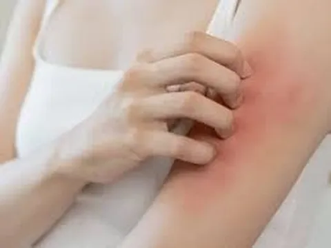 Mẹo dân gian trị ngứa da: Hiệu quả đến đâu?