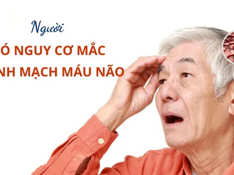 Đối tượng nào có nguy cơ mắc bệnh phình mắc bệnh phình mạch máu não?